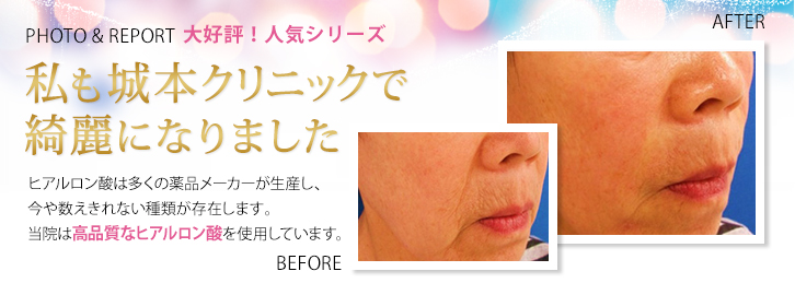 体験レポートを読む