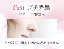 ヒアルロン酸注入