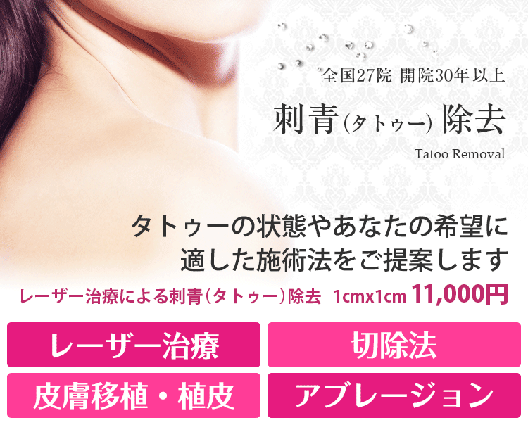 刺青・タトゥー除去