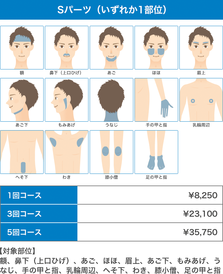 医療レーザー脱毛 男性Sパーツ:額、鼻下(上口ひげ)、あご、ほほ、眉上、あご下、もみあげ、うなじ、手の甲と指、乳輪周辺、へそ下、わき、膝小僧、足の甲と指のいずれか一部位